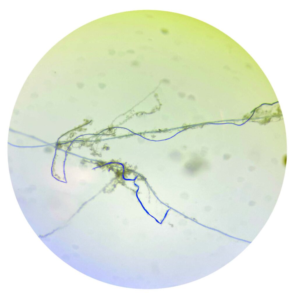 Microscopic view of plant tissue intertwined with microplastic found in a water sample from the Po River delta in 2024. 