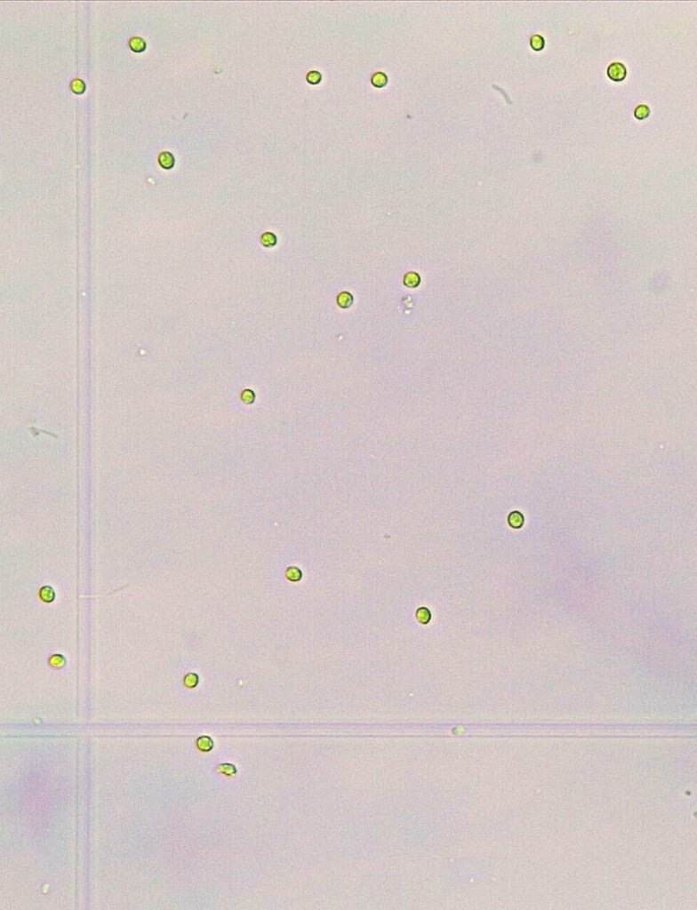 microscope photo of Chlorella sorokiniana