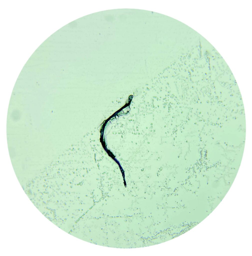 Microscopic view of plant tissue intertwined with microplastic found in a water sample from the Po River delta in 2024. 